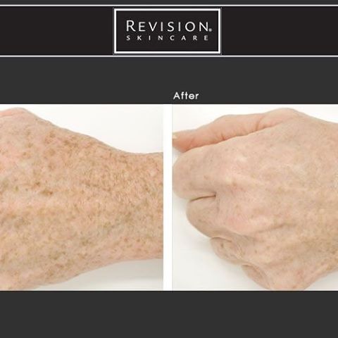 Revision Skincare Lumiquin Hand Cream