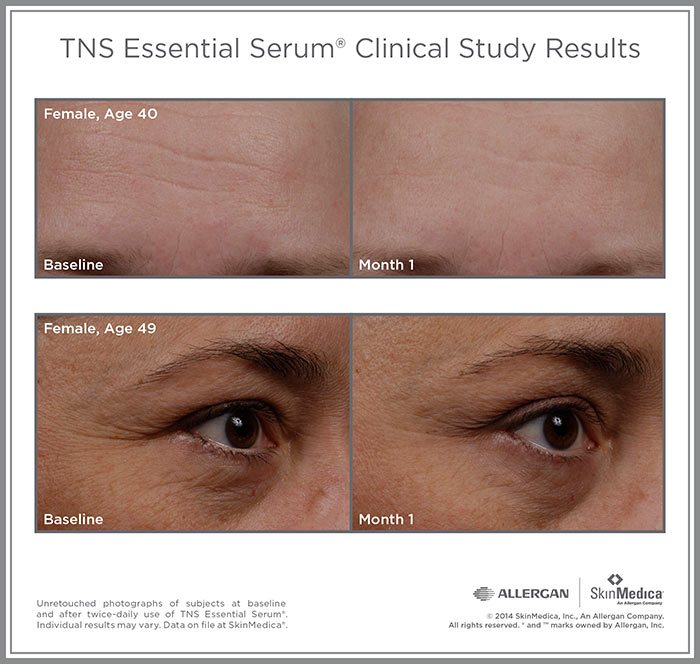 SkinMedica - TNS Essential Serum