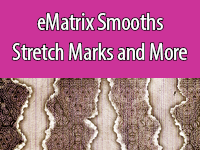 Stretch Marks can be treated with eMatrix, which encourages collagen growth.